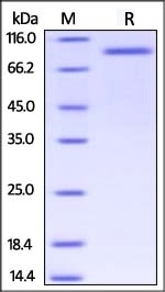 Her2 Recombinant Protein