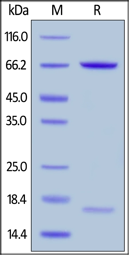 PCSK9 Recombinant Protein