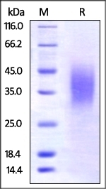 BTLA Recombinant Protein