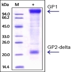 Ebolavirus Glycoprotein Recombinant Protein