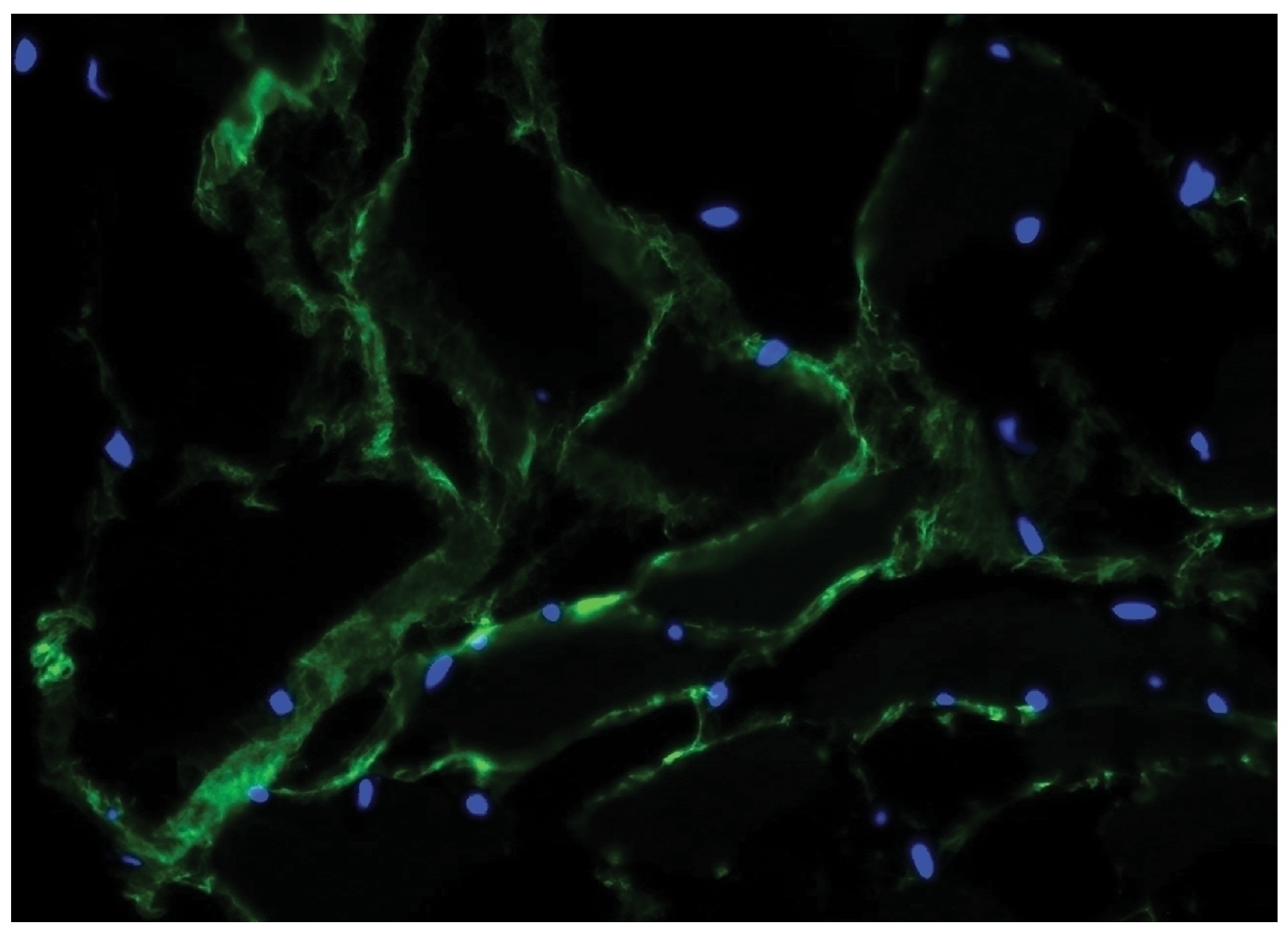 Fibrillin Antibody [11C1.3]
