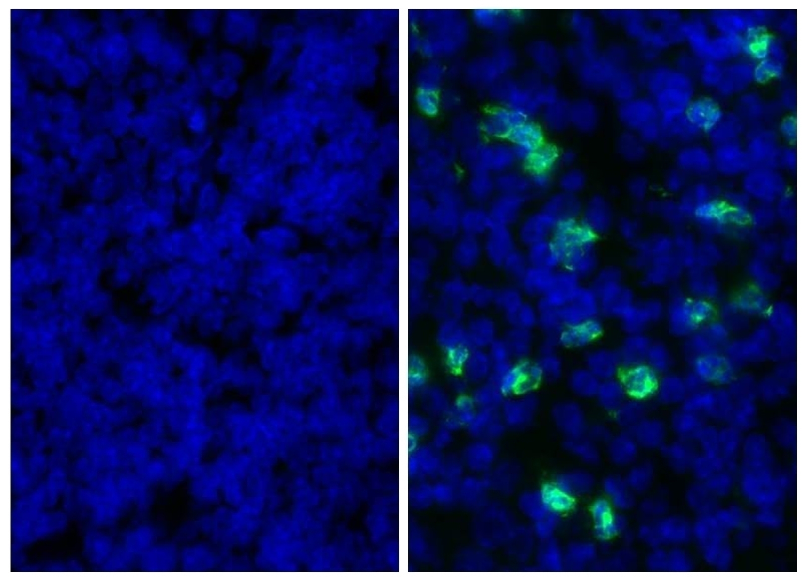 Ly-6G/Ly-6C Antibody [RB6-8C5]