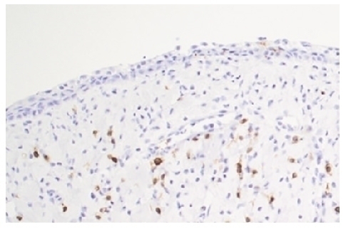CD3e Antibody [PPT3]