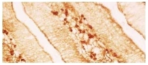 IgA Antibody [A-1]