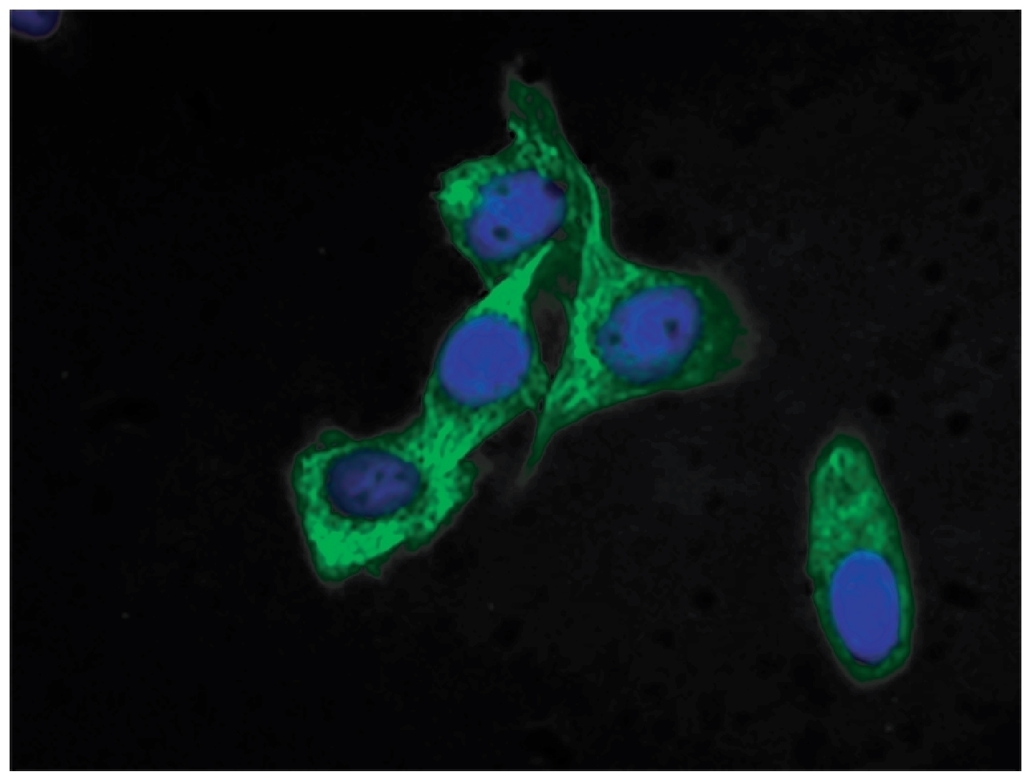 Cytokeratin 18 Antibody [SB38b] (FITC)