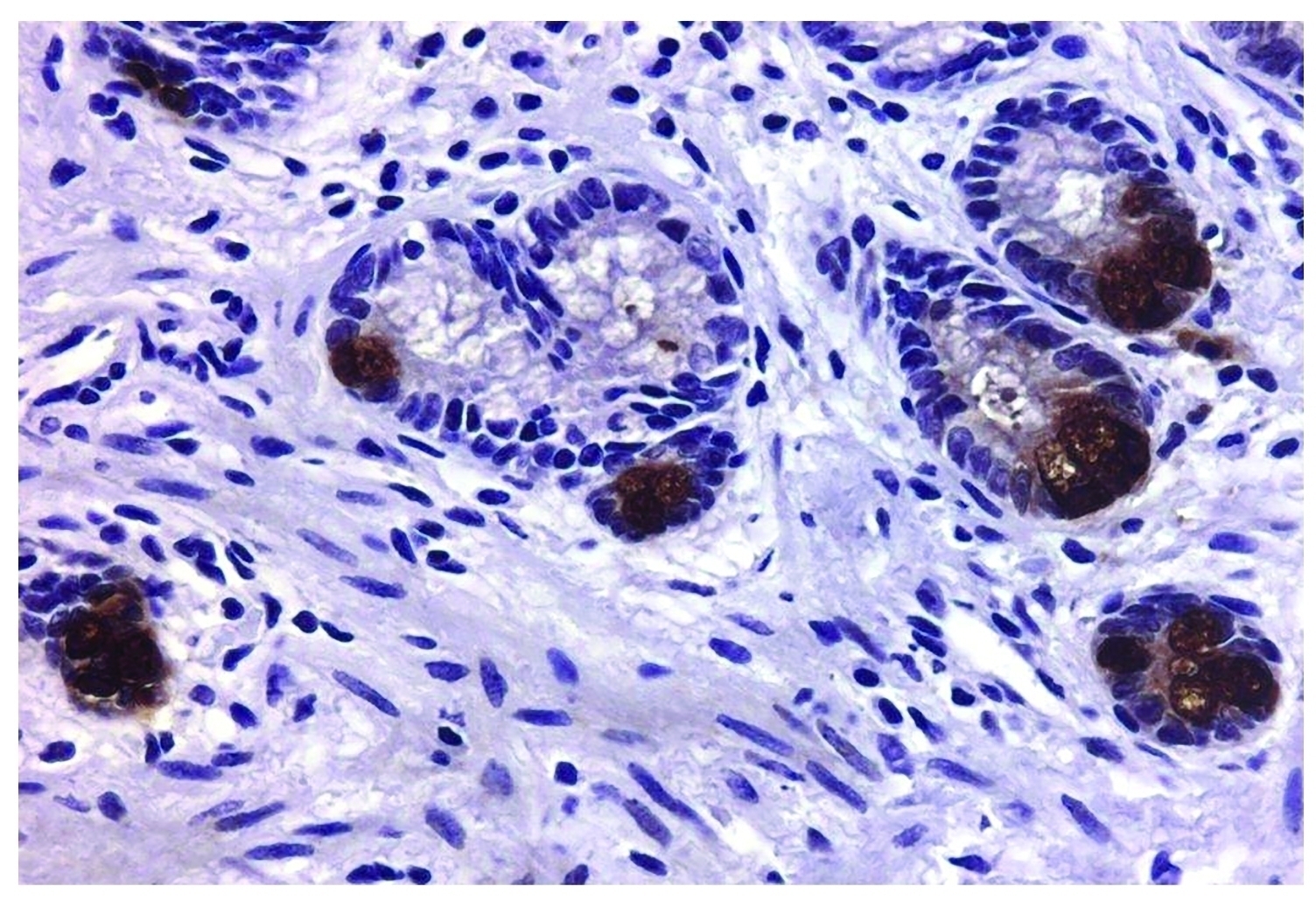 MMP-9 Antibody [SB15c]