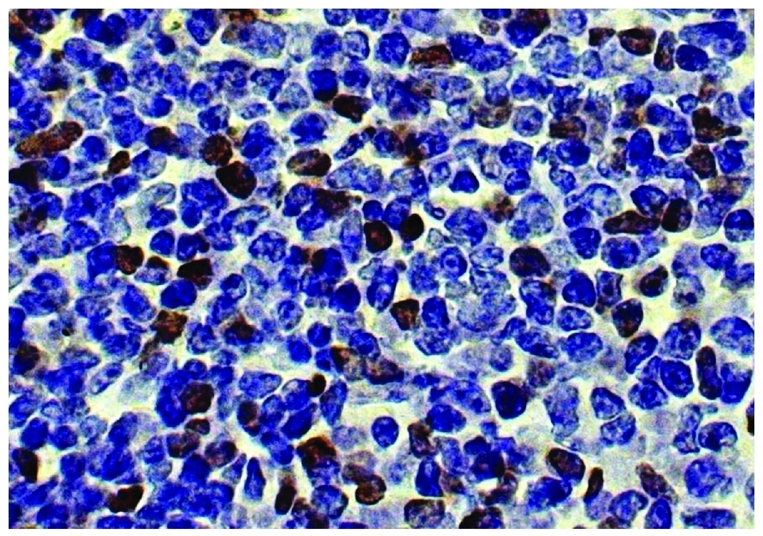 Foxp3 Antibody [SB168a]