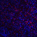Immunofluorescence of ABCA7 in human spleen tissue with ABCA7 antibody at 20 μg/ml.<br><br>Red: ABCA7 Antibody (6889) <br> Blue: DAPI staining