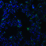 <strong>Figure 8 Immunofluorescence Validation of ACE2 in Rat Lung Tissue</strong><br> Immunofluorescent analysis of 4% paraformaldehyde-fixed rat lung tissue labeling ACE-2 with 3215 at 20 ug/mL, followed by goat anti-rabbit IgG secondary antibody at 1/500 dilution (green) and DAPI staining (blue).