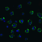 <strong>Figure 9 Immunofluorescence Validation of ACE2 In Caco2 Cells </strong><br>  Immunofluorescent analysis of 4% paraformaldehyde-fixed Caco2 cells labeling ACE2 with 3215 at 20 ug/mL, followed by goat anti-rabbit IgG secondary antibody at 1/500 dilution (green) and DAPI staining (blue).  Image showing membrane staining on Caco2 cells.