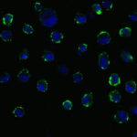 <strong>Figure 11 Immunofluorescence Validation of ACE2 In Caco2 Cells </strong><br> Immunofluorescent analysis of 4% paraformaldehyde-fixed Caco2 cells labeling ACE2 with 3227 at 20 μg/mL, followed by goat anti-rabbit IgG secondary antibody at 1/500 dilution (green) and DAPI staining (blue).  Image showing membrane staining on Caco2 cells.