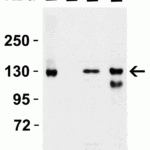 <strong>Figure 2 Western Blot Validation in Human Tissues</strong><br>Loading: 15 μg of lysates per lane.Antibodies: ACE2, 3215 (2 μg/mL),  1h incubation at RT  in 5% NFDM/TBST.Secondary: Goat anti-rabbit IgG HRP conjugate at 1:10000 dilution.