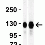 <strong>Figure 2 Western Blot Validation in Human Tissues</strong><br>Loading: 15 μg of lysates per lane.Antibodies: ACE2, 3227 (1 μg/mL),  1h incubation at RT  in 5% NFDM/TBST.Secondary: Goat anti-rabbit IgG HRP conjugate at 1:10000 dilution.