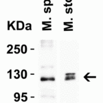 <strong>Figure 3 Western Blot Validation in Mouse Tissues</strong><br>Loading: 15 μg of lysates per lane.Antibodies: ACE2, 3215 (2 μg/mL),  1h incubation at RT  in 5% NFDM/TBST.Secondary: Goat anti-rabbit IgG HRP conjugate at 1:10000 dilution.