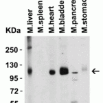<strong>Figure 3 Western Blot Validation in Mouse Tissues </strong><br>Loading: 15 μg of lysates per lane.Antibodies: ACE2, 3217 (2 μg/mL),  1h incubation at RT  in 5% NFDM/TBST.Secondary: Goat anti-rabbit IgG HRP conjugate at 1:10000 dilution.