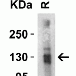 <strong>Figure 3 Western Blot Validation in Rat Brain Tissue</strong><br>Loading: 15 μg of lysates per lane.Antibodies: ACE2, 3229 (4 μg/mL),  1h incubation at RT  in 5% NFDM/TBST.Secondary: Goat anti-rabbit IgG HRP conjugate at 1:10000 dilution.