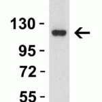 <strong>Figure 4 Western Blot Validation in Rat Skin Tissue</strong><br>Loading: 15 μg of lysates per lane.Antibodies: ACE2, 3215 (2 μg/mL),  1h incubation at RT  in 5% NFDM/TBST.Secondary: Goat anti-rabbit IgG HRP conjugate at 1:10000 dilution.