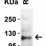 <strong>Figure 4 Western Blot Validation in Rat Thymus Tissue</strong><br>Loading: 15 μg of lysates per lane.Antibodies: ACE2, 3227 (2 μg/mL),  1h incubation at RT  in 5% NFDM/TBST.Secondary: Goat anti-rabbit IgG HRP conjugate at 1:10000 dilution.