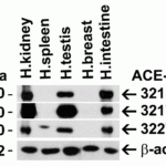 <strong>Figure 1 Independent Antibody Validation (IAV) via Protein Expression Profile in Human Tissues</strong><br>Loading: 15 μg of lysates per lane.Antibodies: ACE2, 3215 (2 μg/mL), ACE2, 3217 (2 μg/mL), ACE2, 3227 (2 μg/mL) and beta-actin 3779  (1 μg/mL),  1h incubation at RT  in 5% NFDM/TBST.Secondary: Goat anti-rabbit IgG HRP conjugate at 1:10000 dilution.