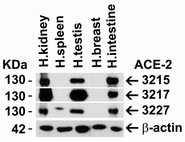 ACE2 Antibody