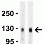 <strong>Figure 1 Western Blot Validation in Human Tissues</strong><br>Loading: 15 µg of lysates per lane.Antibodies: ACE2, 3229 (4 μg/mL),  1h incubation at RT  in 5% NFDM/TBST.Secondary: Goat anti-rabbit IgG HRP conjugate at 1:10000 dilution.