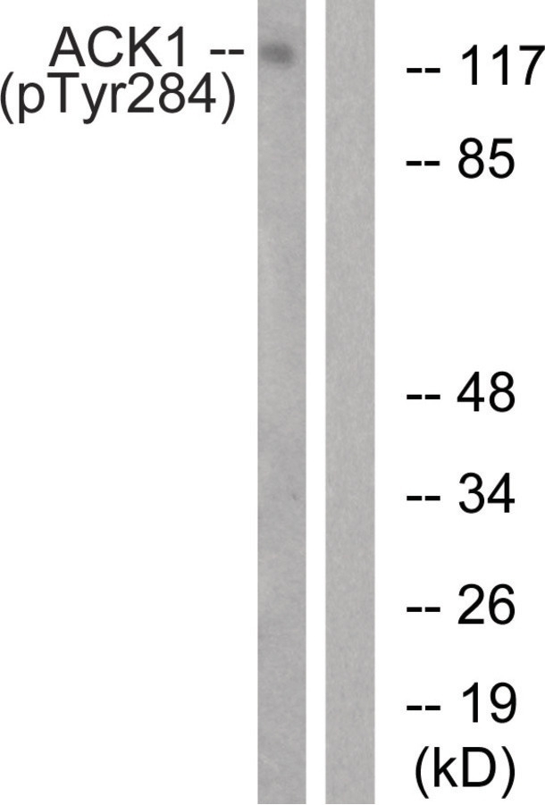 ACK1 (phospho Tyr284) Antibody