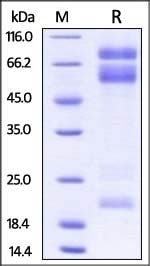 ADAM17 Recombinant Protein