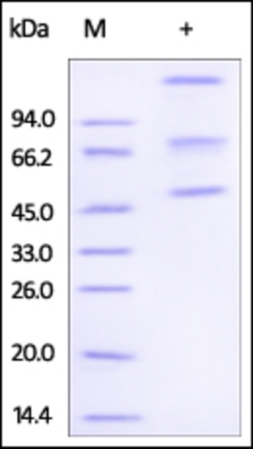 ADAM8 Recombinant Protein