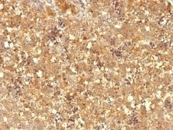 AFP Antibody [MBS-12]
