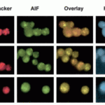 <strong>Figure 7  Subcellular Localization Validation of AIF in mononuclear cells  (Gupta et al., 2003) </strong><br> A shows mononuclear cells (MNCs) alone, B shows MNCs transfected with control plasmid, C shows MNCs transfected with Bcl-2 expression plasmid. Overlay is of Mitotracker (red) and AIF (green). Hoechst 33258 dye is used to examine chromatin fragmentation. The release of AIF form mitochondria is detected by anti-AIF antibodies.