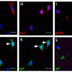 <strong>Figure 8 Immunofluorescence Validation of AIF in Rat Hippocampal Neurons (Hofer et al., 2011)</strong><br>(G-L) After exposure to bacterial components, AIF colocalized in mature neurons (MAP2; I, L), immature neurons (DcX;H, K), and stem/progenitor cells (Nestin; G, J). AIF expression was detected by anti-AIF antibodies.