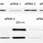 <strong>Figure 4  KD and Induced Validation of AIF  in H1299 Cells(Stambolsky et al., 2006) </strong><br>Western blot analysis of AIF knockdown with anti-AIF antibodies in H1299 cells. AIF expression was disrupted in AIF knockdown cells (siRNA1 and siRNA4). An increased expression of AIF was induced by ZnCl2 treatment, which was not observed in AIF knockdown cells.