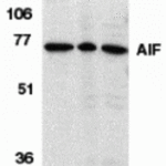 <strong>Figure 1 Western Blot Validation in Different Species</strong><br>Loading: 15 μg of lysates per lane.Antibodies: AIF 2267, (1 µg/mL), 1h incubation at RT in 5% NFDM/TBST.Secondary: Goat anti-rabbit IgG HRP conjugate at 1:10000 dilution.Lane A: Human K562 cellsLane B: Rat heartLane C: Mouse heart