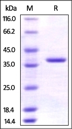 AIMP1 Recombinant Protein