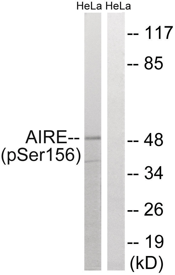 AIRE (phospho Ser156) Antibody