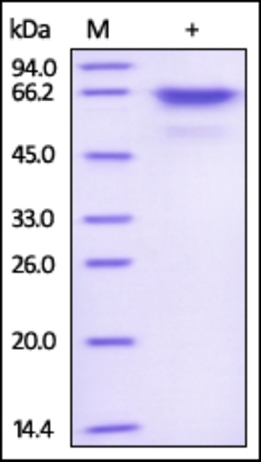 AKT1 Recombinant Protein