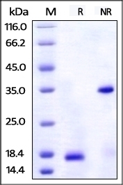 ALCAM Recombinant Protein