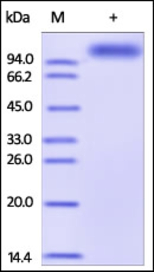 ALCAM Recombinant Protein