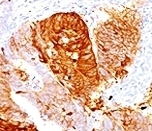 ALDH1 Antibody [AHDH1-1]