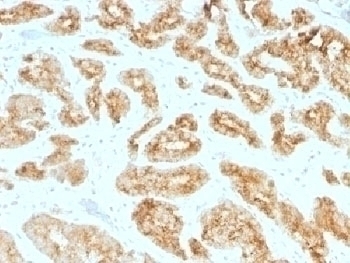 AMACR / p504S Antibody [AMACR/1723]