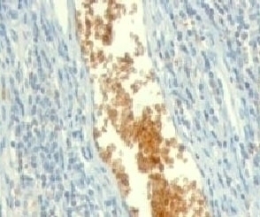 AMPD3 Antibody [ETAD3-1]