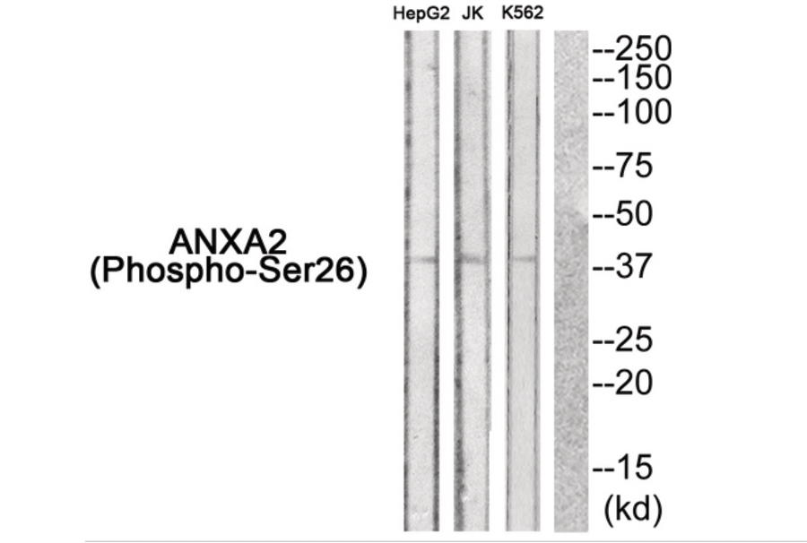 ANXA2 (phospho Ser26) Antibody