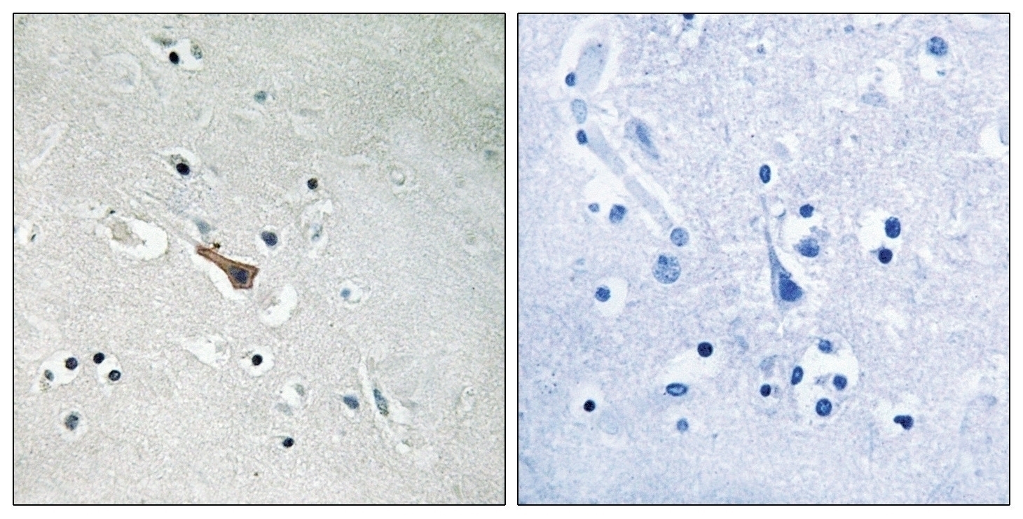 APLP2 (phospho Tyr755) Antibody