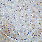 Immunohistochemistry of APP in mouse brain tissue with APP Antibody at 5 μg/mL.
