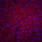Immunofluorescence of ARID1A in mouse brain tissue with ARID1A antibody at 20 μg/ml.