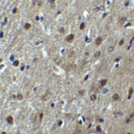 Immunohistochemistry of ARID1A in mouse brain tissue with ARID1A antibody at 5 μg/mL.