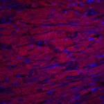 Immunofluorescence of ASAH1 in rat heart tissue with ASAH1 antibody at 20 μg/mL.<br><br>Red: ASAH1 Antibody (4741) <br> Blue: DAPI staining