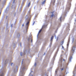 Immunohistochemistry of ASAH1 in rat heart tissue with ASAH1 antibody at 5 μg/mL.