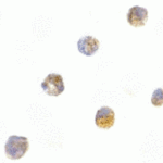 <strong>Figure 6 Immunocytochemistry Validation of ASC in HL60 Cells</strong><br>Immunocytochemical analysis of HL60 cells using anti-ASC antibody (2287) at 5 μg/ml. Cells was fixed with formaldehyde and blocked with 10% serum for 1 h at RT; antigen retrieval was by heat mediation with a citrate buffer (pH6). Samples were incubated with primary antibody overnight at 4°C. A goat anti-rabbit IgG H&L (HRP) at 1/250 was used as secondary. Counter stained with Hematoxylin.