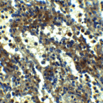 <strong>Figure 4 Immunohistochemistry Validation of ASC in Human Spleen Tissue </strong><br> Immunohistochemical analysis of paraffin-embedded human spleen tissue using anti-ASC antibody (2287) at 2.5 μg/ml. Tissue was fixed with formaldehyde and blocked with 10% serum for 1 h at RT; antigen retrieval was by heat mediation with a citrate buffer (pH6). Samples were incubated with primary antibody overnight at 4°C. A goat anti-rabbit IgG H&L (HRP) at 1/250 was used as secondary. Counter stained with Hematoxylin.